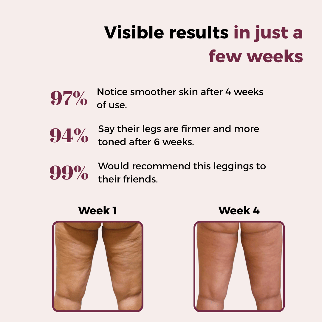 Fitshirt™ 3D Anti-Cellulite Leggings